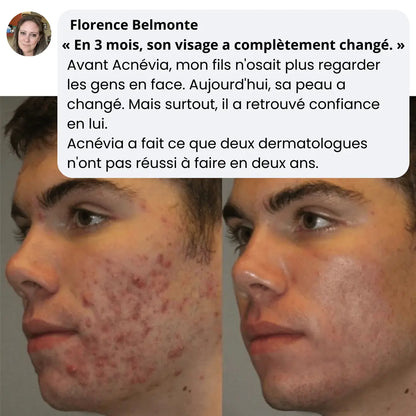 Acnévia™ Nourrit Sa Peau Et Redonne le Sourire à Votre Ado